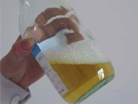 尿蛋白弱阳性