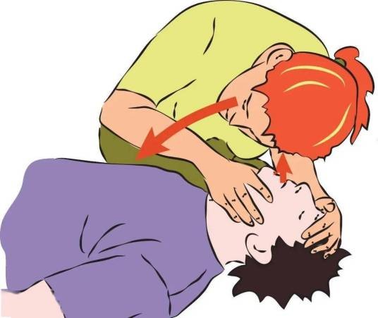 初期心肺复苏