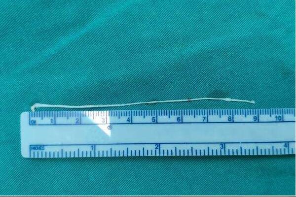 5毫米等于多少厘米？