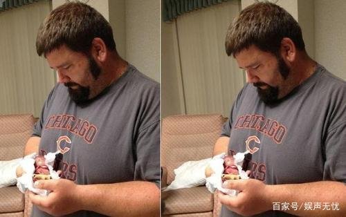 “比手掌还小”，世界最小婴儿走红，如今现状怎样了？