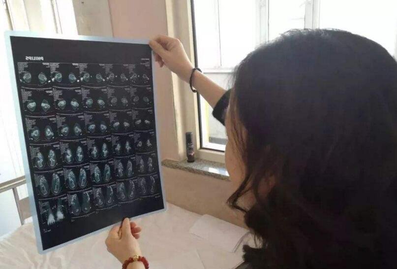 兰州兽研所布病确认阳性3245人，竟与药厂使用过期消毒剂有关？