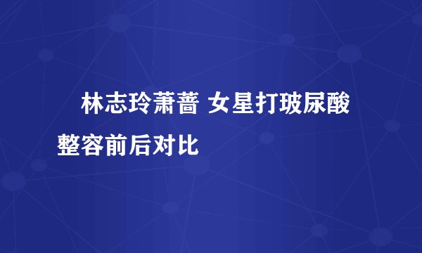 林志玲萧蔷 女星打玻尿酸整容前后对比