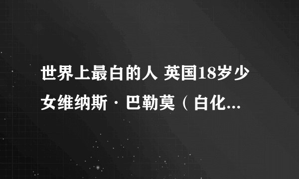 世界上最白的人 英国18岁少女维纳斯·巴勒莫（白化病萝莉）