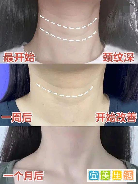 网络热议的御龄双子针是什么？