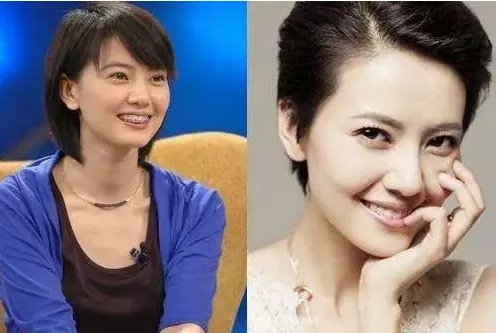 孙杨证明，牙齿正畸能让你变得更美！