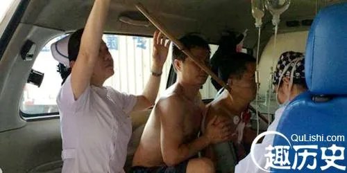 男子被竹竿穿颈 情况紧急护士跪地扶竿稳住