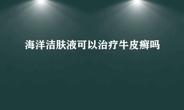 海洋洁肤液可以治疗牛皮癣吗