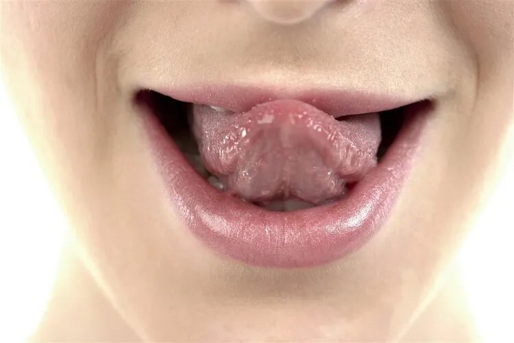 舌头吐露的身体秘密:看看舌头,5种问题对照了就知道