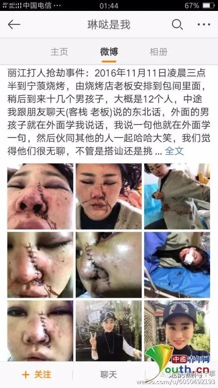 关于丽江被打毁容女子再发声的介绍。