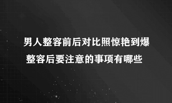 男人整容前后对比照惊艳到爆 整容后要注意的事项有哪些