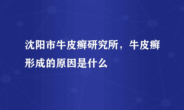 沈阳市牛皮癣研究所，牛皮癣形成的原因是什么