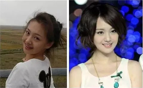 孙杨证明，牙齿正畸能让你变得更美！