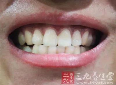 5分钟消除所有牙垢 过程太刺激