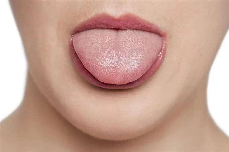 舌头吐露的身体秘密：看看舌头，5种问题对照了就知道