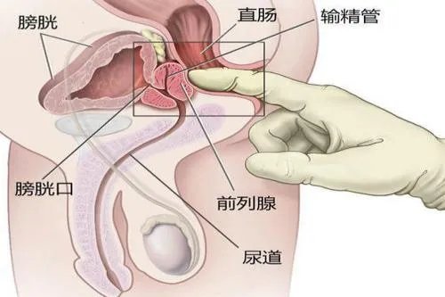 前列腺按摩手法和位置图解