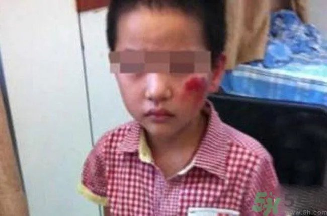男孩遭校长暴打的结果是什么?男孩遭校长暴打的真相是什么?