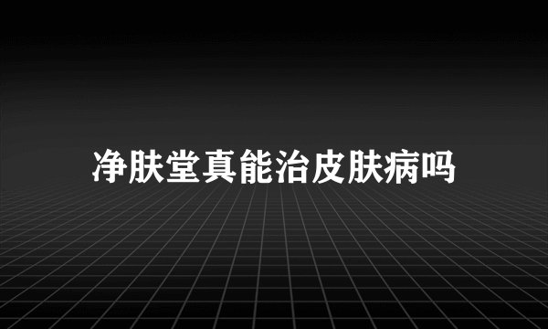 净肤堂真能治皮肤病吗