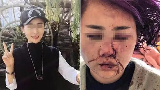 关于丽江被打毁容女子再发声的介绍。