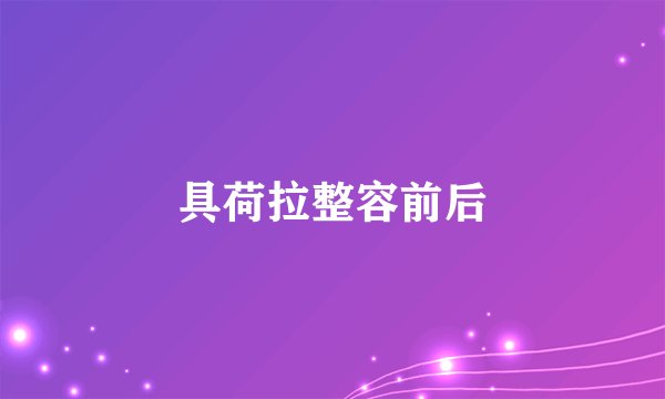 具荷拉整容前后