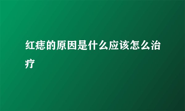 红痣的原因是什么应该怎么治疗