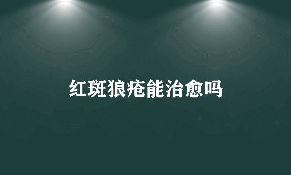 红斑狼疮能治愈吗