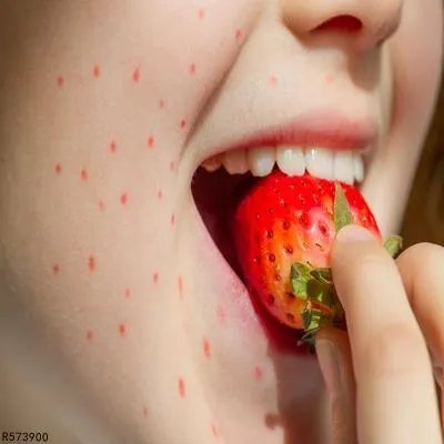全身弥漫性潮红需要做哪些检查