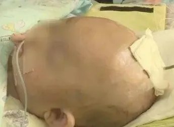 女婴被砸涉案人已经被确定了吗?