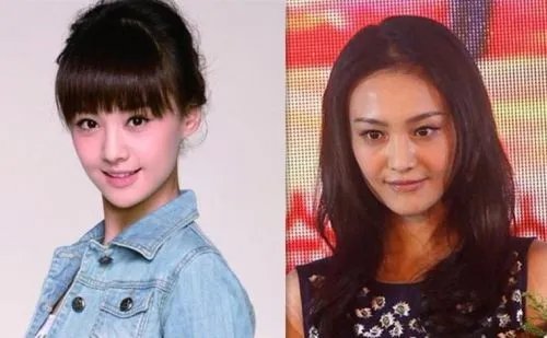 郑爽整容之后的五官是什么样子的,感觉如何?