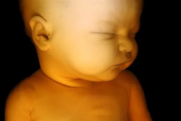 黑龙江产妇丈夫讲述遭遇,女人生孩子要面临10大风险,重者致命