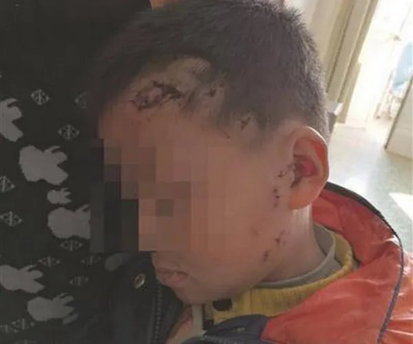 男孩被二哈扑咬是怎么回事?