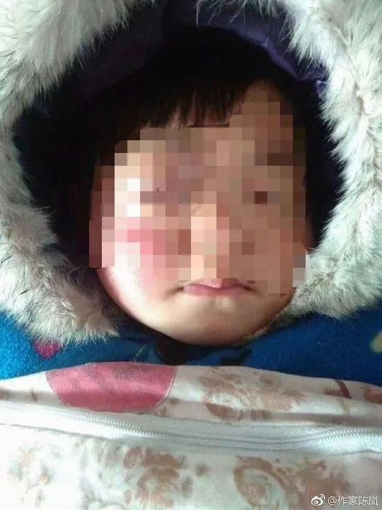 夫妻疑用女儿诈捐后果会怎么样?