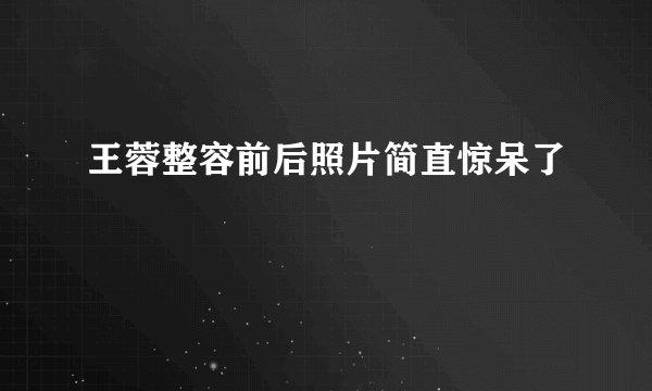 王蓉整容前后照片简直惊呆了
