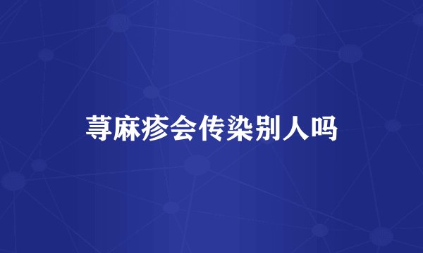 荨麻疹会传染别人吗