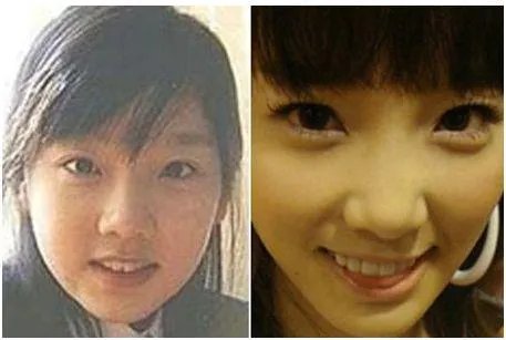 少女时代整容前后照片对比 少女时代为什么叫女帝
