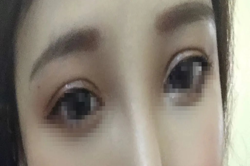 双眼皮有几种眼型图片