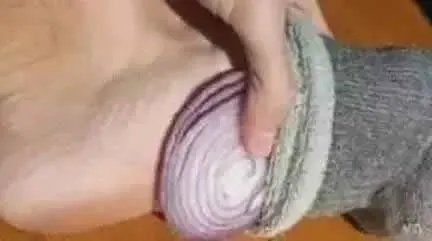 洋葱放入耳朵一夜奇迹出现了（图）