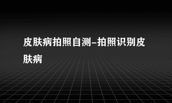皮肤病拍照自测-拍照识别皮肤病