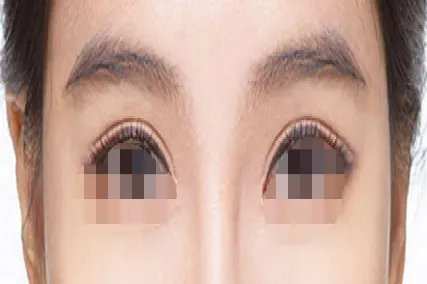 双眼皮有几种眼型图片