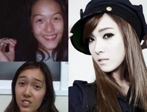 少女时代整容前后照片对比 少女时代为什么叫女帝