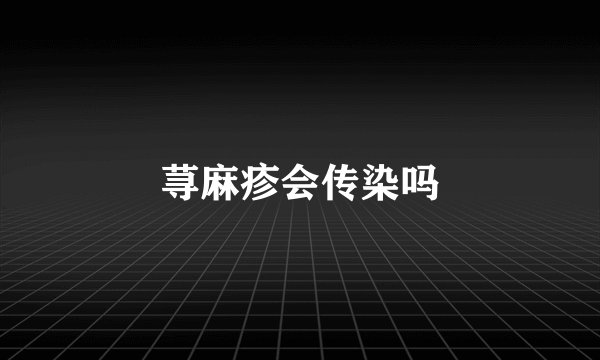 荨麻疹会传染吗