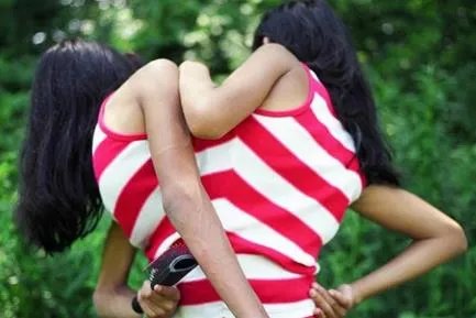 连体姐妹的共享生活:一辈子在一起(组图)