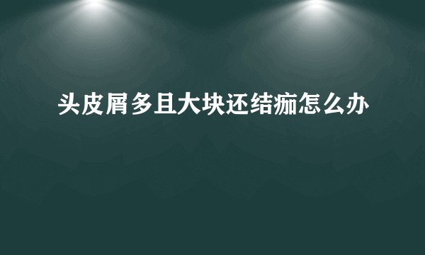 头皮屑多且大块还结痂怎么办