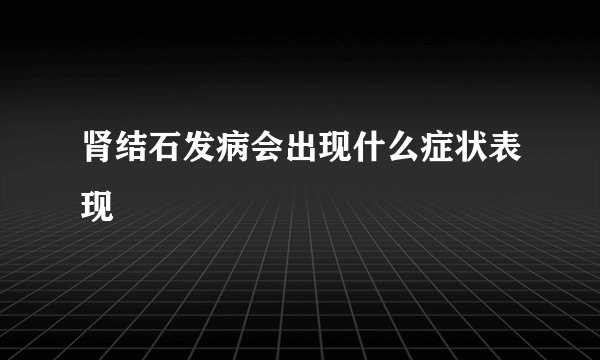 肾结石发病会出现什么症状表现