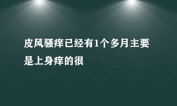 皮风骚痒已经有1个多月主要是上身痒的很
