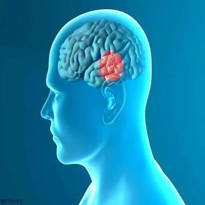 多发腔隙性脑梗塞要注意什么