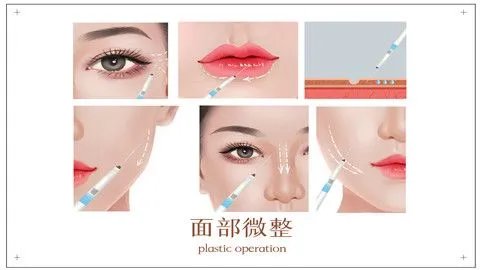 除皱针的价格