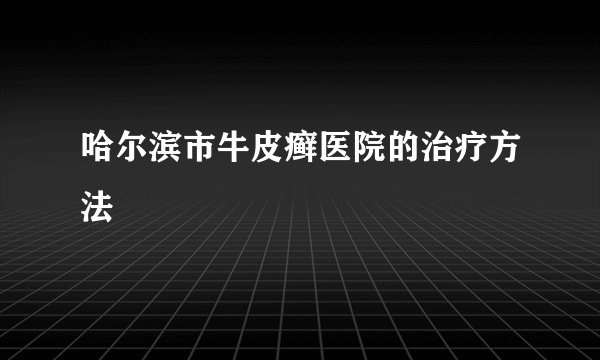 哈尔滨市牛皮癣医院的治疗方法