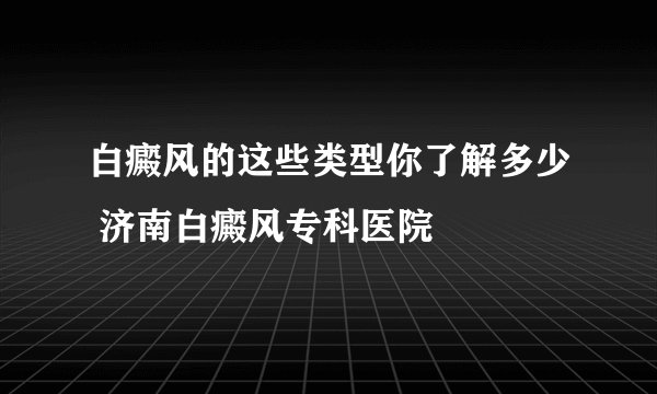 白癜风的这些类型你了解多少 济南白癜风专科医院