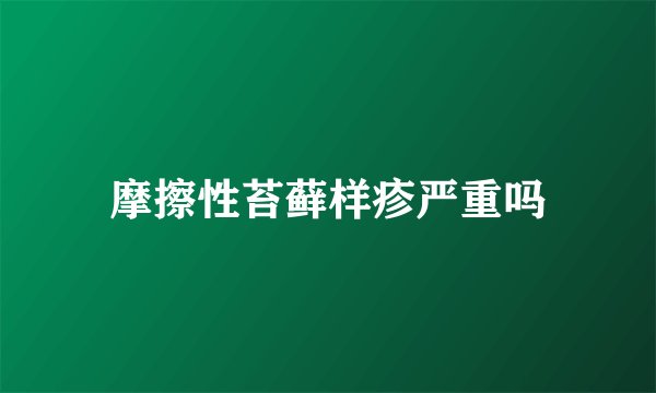 摩擦性苔藓样疹严重吗