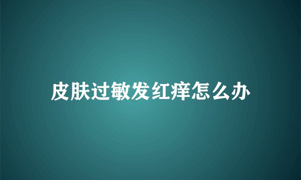 皮肤过敏发红痒怎么办